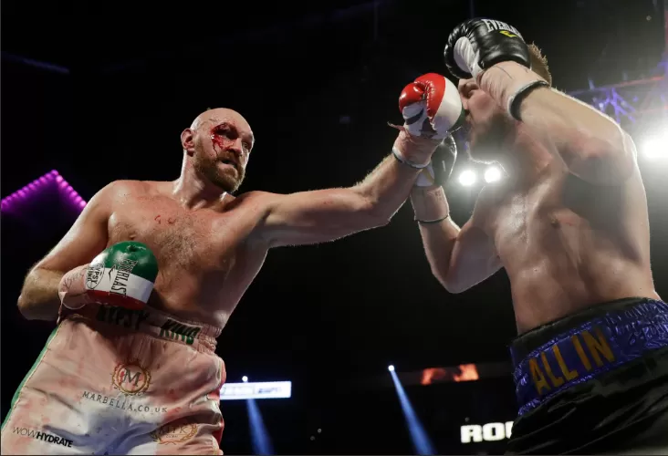 (FOTO-VIDEO) Tyson Fury unatoč velikoj posjekotini savladao Otta Wallina nakon teških 12 rundi